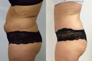 SLIM-SP02-12